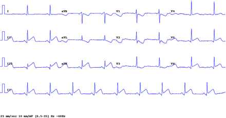 Figure 4